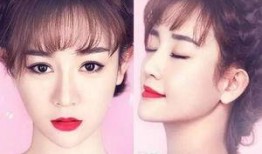 香港艺人整容爆料视频,揭秘背后真相与争议