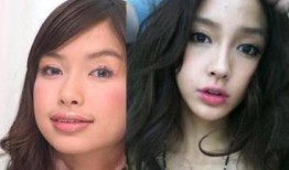 香港艺人整容爆料视频,揭秘背后真相与争议